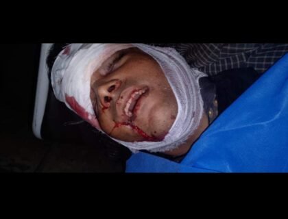 سیالکوٹ(حافظ ریحان خوف ناک حادثہ کو رپورٹ کر رہے ہیں ، سیالکوٹ مشہور گرین ایپل ریسٹورنٹ والی کے قریب چپراڑ روڈ کمانوالہ میں خوف ناک حادثہ ، 30 سالہ شہریار موقع پر جاں بحق ، بیوی زندگی اور موت کی کشمکش میں مبتلا