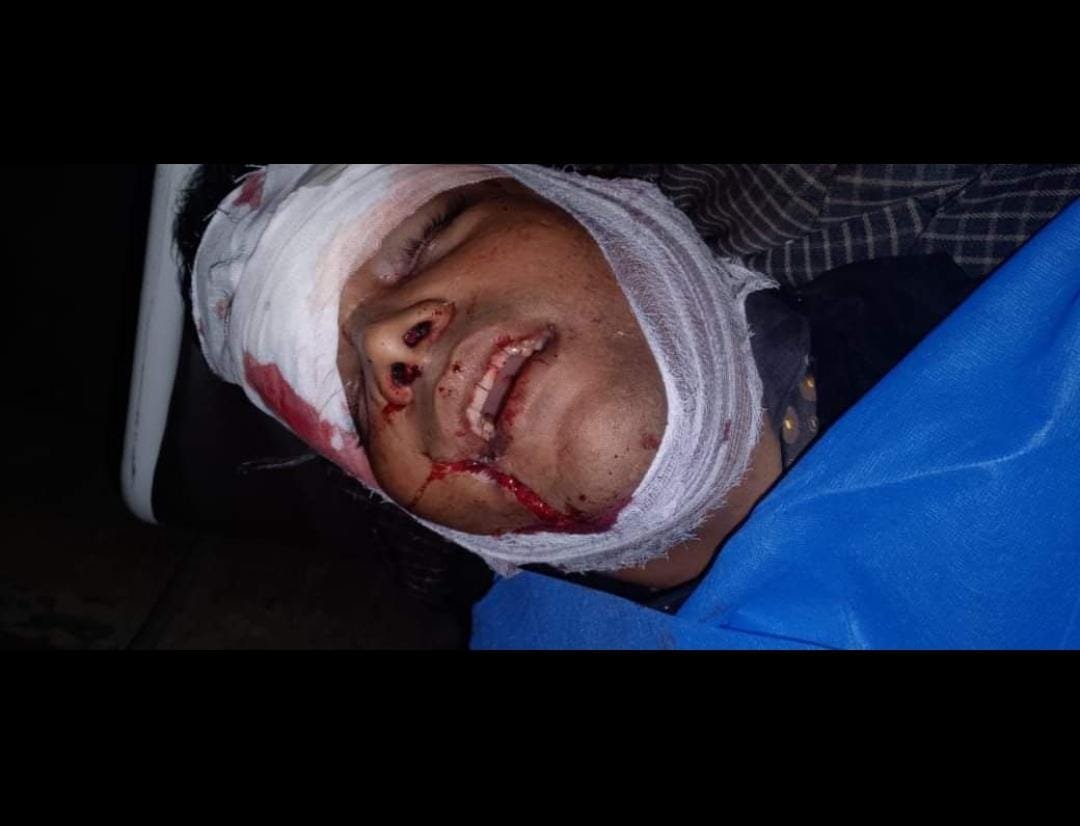 سیالکوٹ(حافظ ریحان خوف ناک حادثہ کو رپورٹ کر رہے ہیں ، سیالکوٹ مشہور گرین ایپل ریسٹورنٹ والی کے قریب چپراڑ روڈ کمانوالہ میں خوف ناک حادثہ ، 30 سالہ شہریار موقع پر جاں بحق ، بیوی زندگی اور موت کی کشمکش میں مبتلا